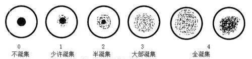 「小科普」51Cr标记法测定红细胞寿命2