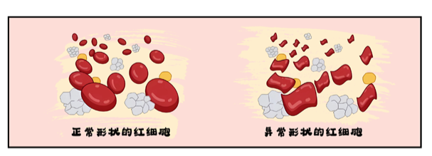 为什么会发生溶血？溶血要如何检测03